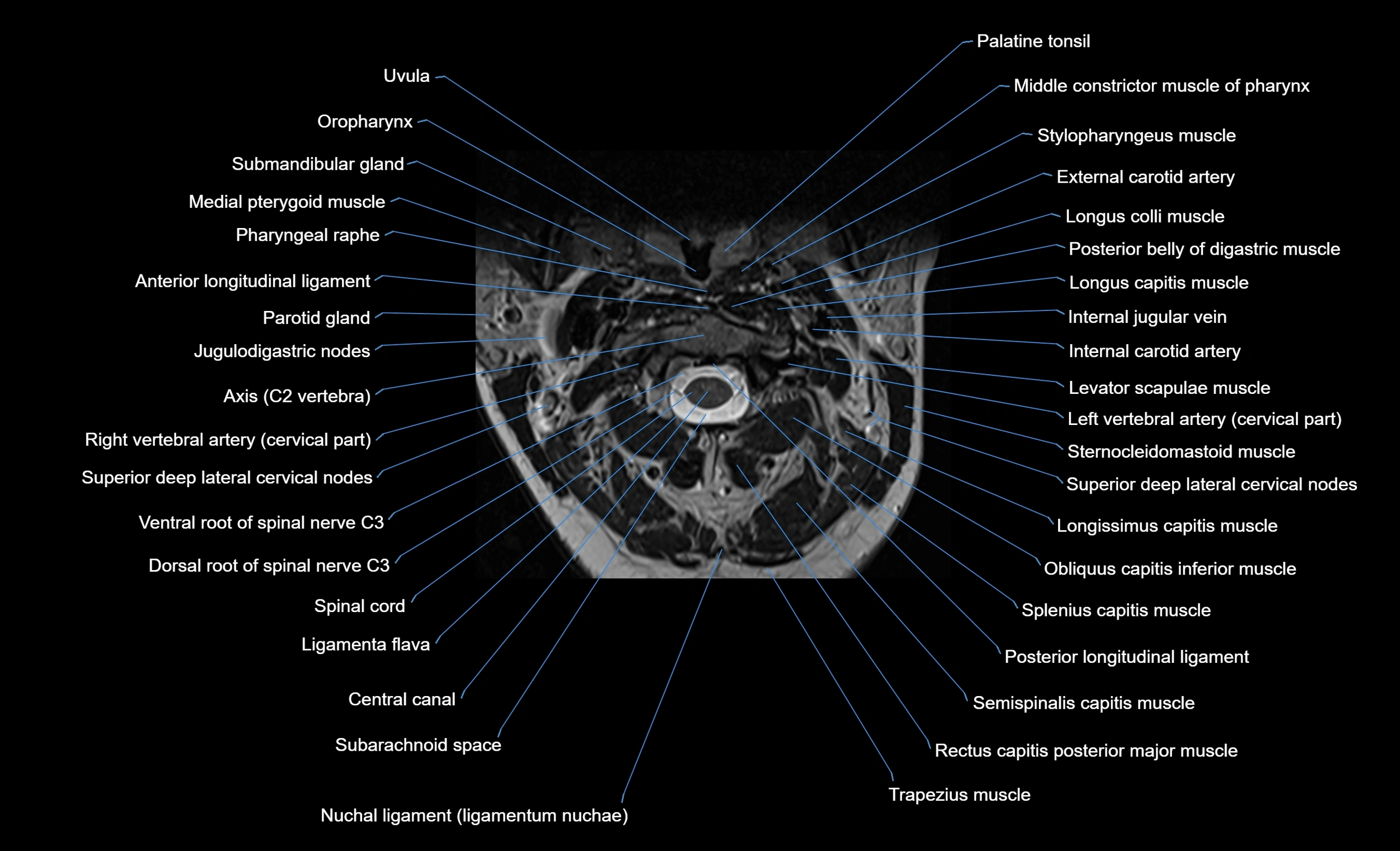cervical spine cross sectional MRI anatomy  3T MRI axial  image-img-00001-00011.webp